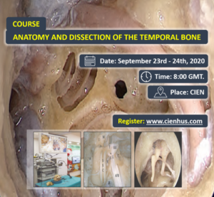 Anatomía y Disección del Hueso Temporal