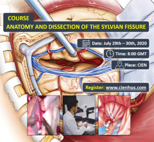 Anatomía y Disección de la Fisura de Silvio