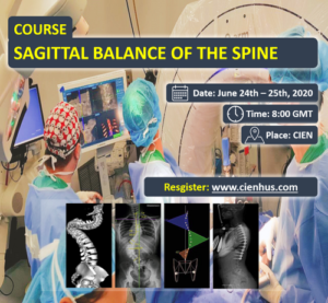 Equilibrio sagital de la columna